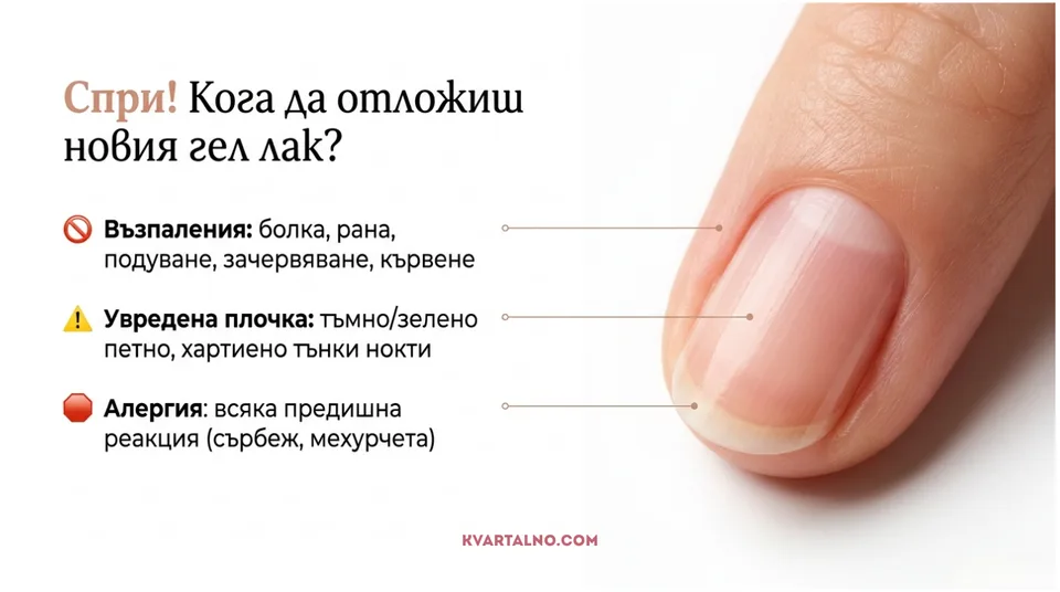 Инфографика кога да отложим нов гел лак при възпаление, увредена плочка или алергична реакция